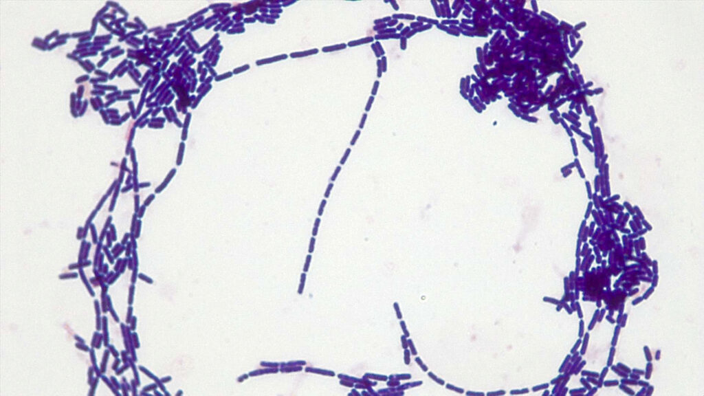 What Are the Gram Staining Results for Bacillus megaterium