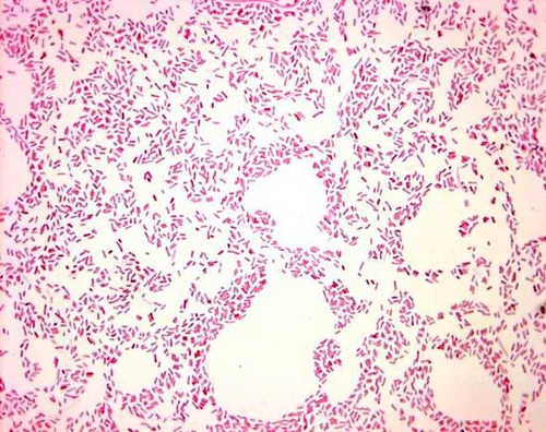 How to Perform Gram Staining on Bacillus megaterium