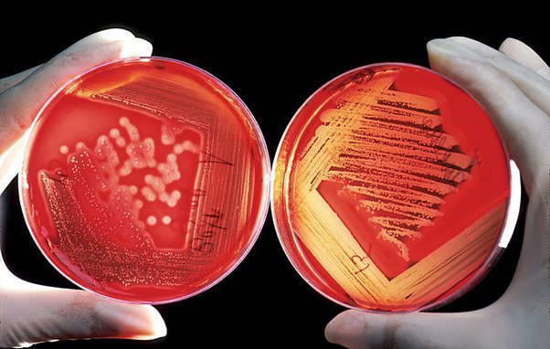 Is Biotechnology Better Than Microbiology